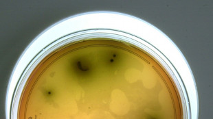 List&eacute;riose: 12 cas, dont 2 mortels, en lien avec des charcuteries d'une entreprise de la Dr&ocirc;me