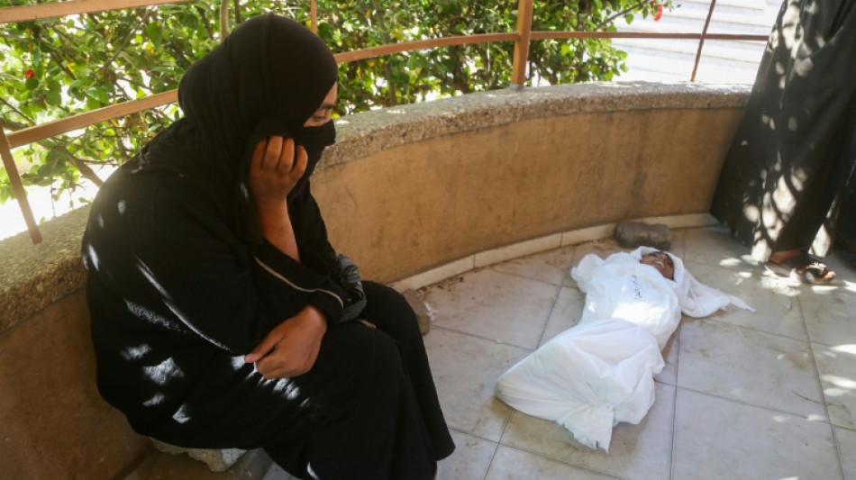 Un hospital de Gaza asegura que 21 niños murieron de hambre o desnutrición 