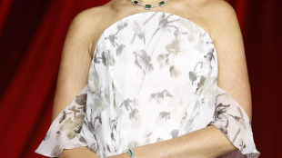 Attrice Gal Gadot rivela, operata al cervello durante gravidanza